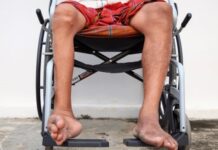 Poliomielitis, enfermedad viral que afecta nervios de médula ósea: IMSS Veracruz Norte