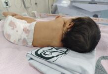 Atiende IMSS Veracruz Norte a bebés prematuros con equipo multidisciplinario y tecnología de vanguardia