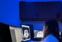 Informa IMSS Veracruz Norte sobre Radiología herramienta esencial para diagnóstico preciso con estudios de imagen