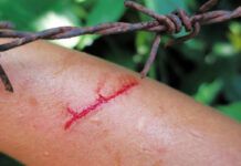 Vacunarse y atender heridas a tiempo previene el tétanos: IMSS Veracruz Norte