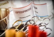 Informa IMSS Veracruz Norte que la atención temprana ayuda a evitar complicaciones por leptospirosis