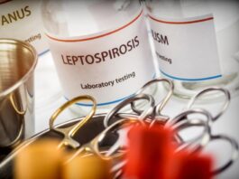 Informa IMSS Veracruz Norte que la atención temprana ayuda a evitar complicaciones por leptospirosis