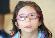 Comunica IMSS Veracruz Norte que identificar Síndrome de Moebius favorece a un diagnóstico oportuno y atención integral