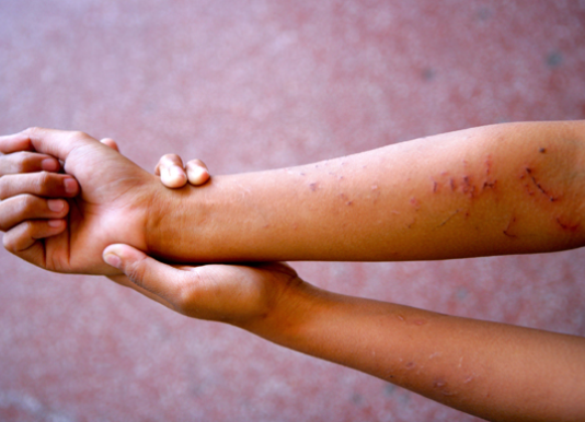 Maltrato infantil, foco rojo para las autoridades veracruzanas / Yamiri Rodríguez Madrid