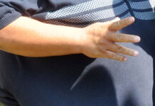 Se disparan los casos de obesidad; en cinco semanas, Salud atendió a 3,300 veracruzanos