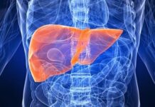 Veracruz, entre los estados con más casos de cirrosis hepática alcohólica