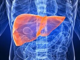 Veracruz, entre los estados con más casos de cirrosis hepática alcohólica