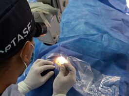 Realiza IMSS Veracruz Norte con éxito Jornada quirúrgica de cataratas