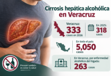 Reporta Salud más de 330 casos de cirrosis hepática en Veracruz