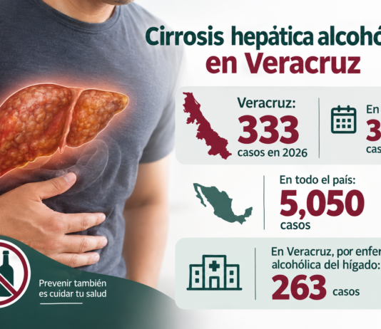 Reporta Salud más de 330 casos de cirrosis hepática en Veracruz