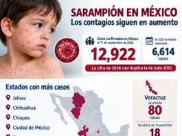 Aumentan casos de sarampión; Veracruz acumula 80