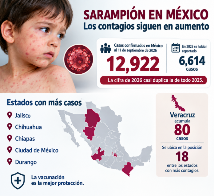 sarampión 1