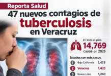 Reporta Salud 47 nuevos contagios de tuberculosis en Veracruz