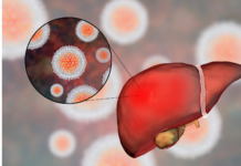 Promueve IMSS Veracruz Norte prevención y detección oportuna de hepatitis C